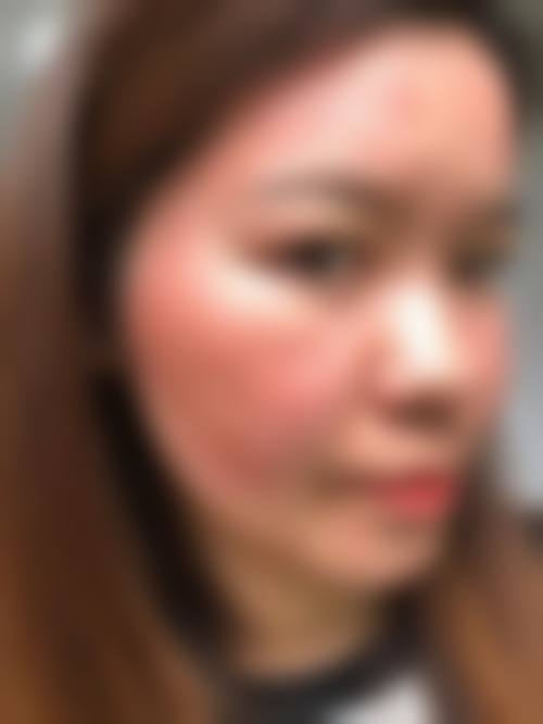 五、哈尔滨诺嬄美整形医疗美容门诊部实例