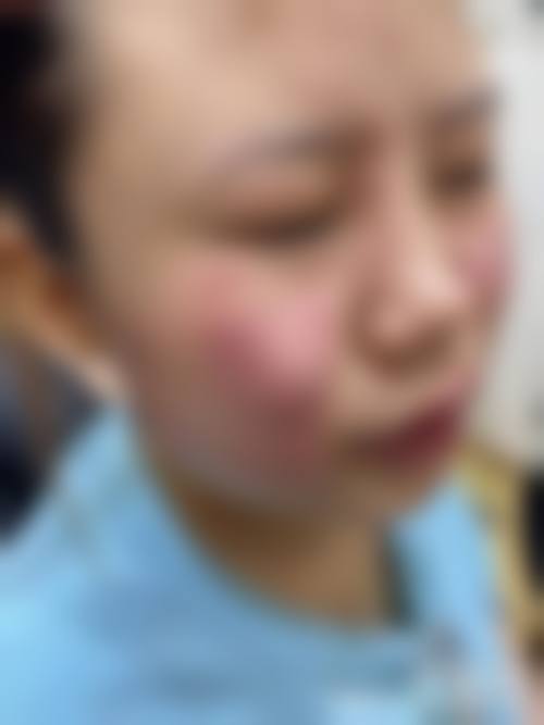 七、新疆库尔勒医院皮肤美容科价格表：（仅供参考）