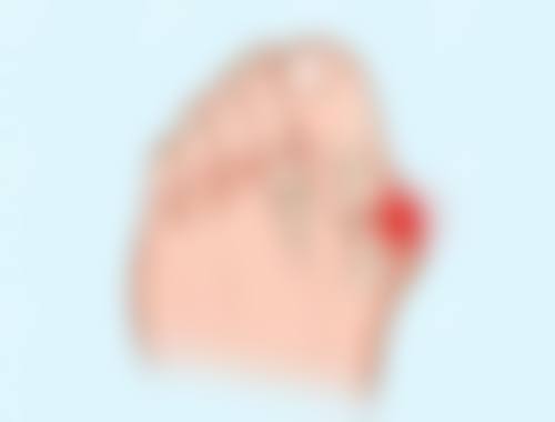 隆胸恢复期究竟多久？不同术式、因素影响下的恢复时间及注意要点揭秘 