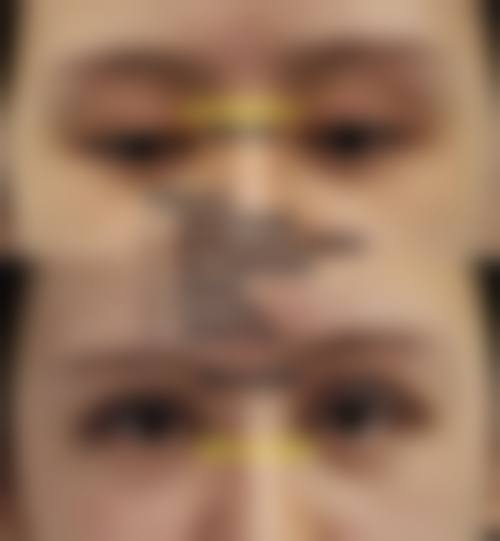 七、深圳科丽研肌医疗美容诊所价格表：（仅供参考）