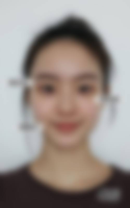 六、福州美琳达医疗美容中 心怎么预约：
