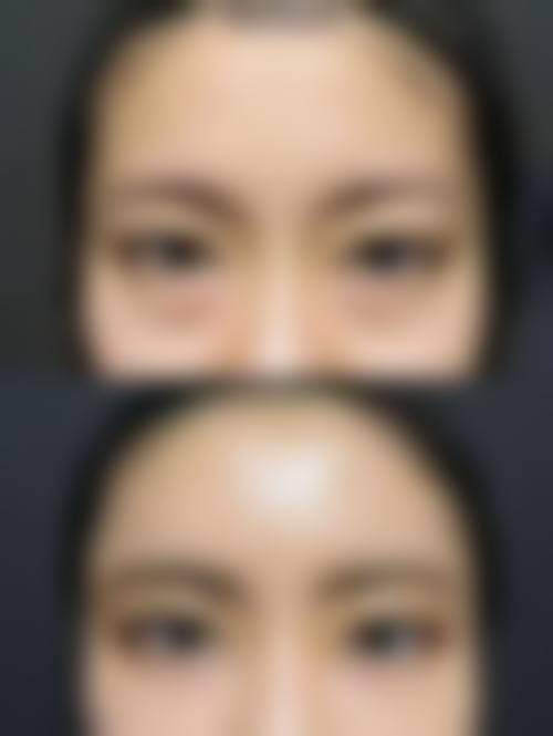 七、呼和浩特市第一医院医疗美容科价格表：（仅供参考）