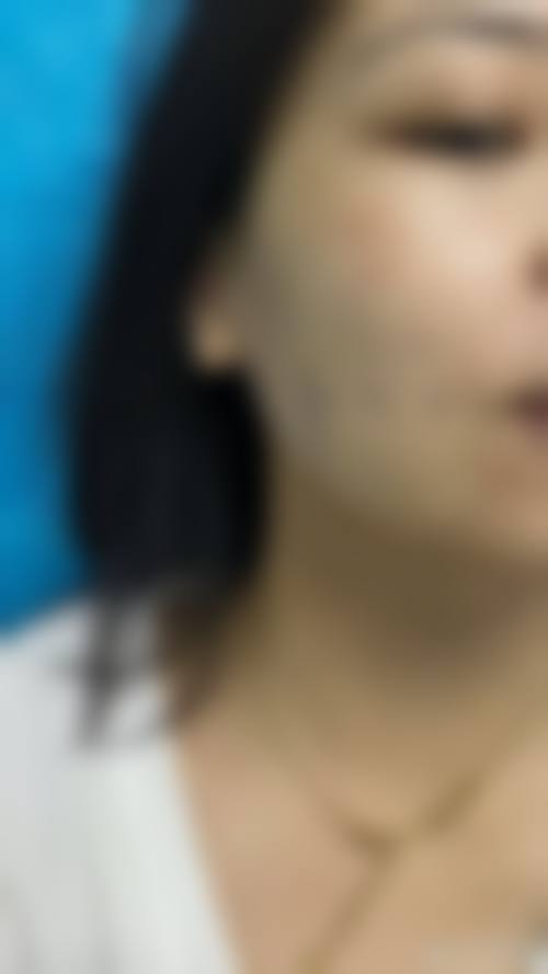 六、宁波海曙美苑整形医院怎么预约：