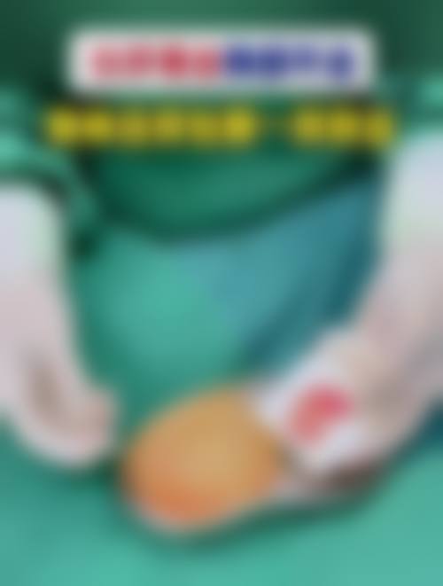 八、宁波海曙美苑整形医院真实的顾客评价如下：