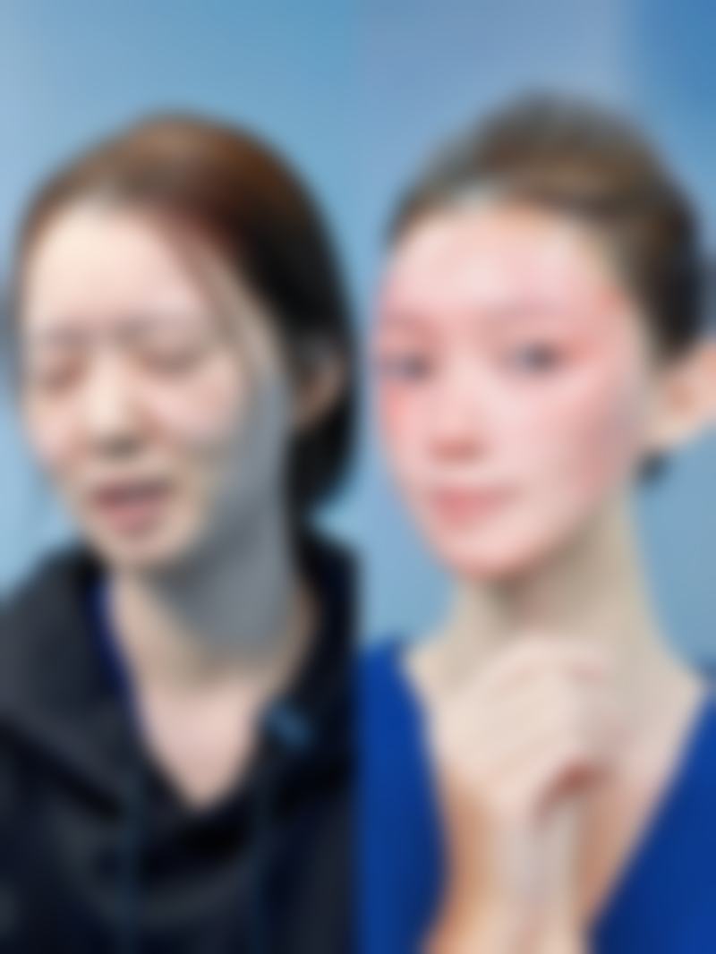 隆胸修复期究竟多久？修复期阶段划分及注意事项