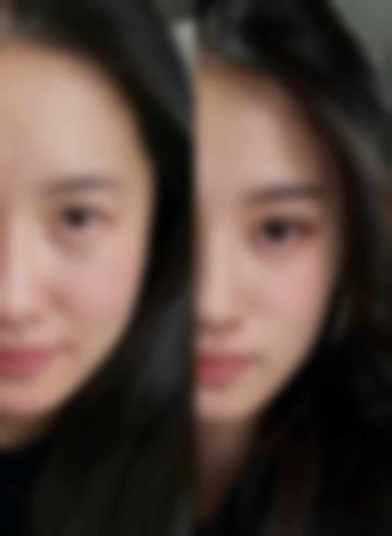 五、福州美琳达医疗美容中 心实例