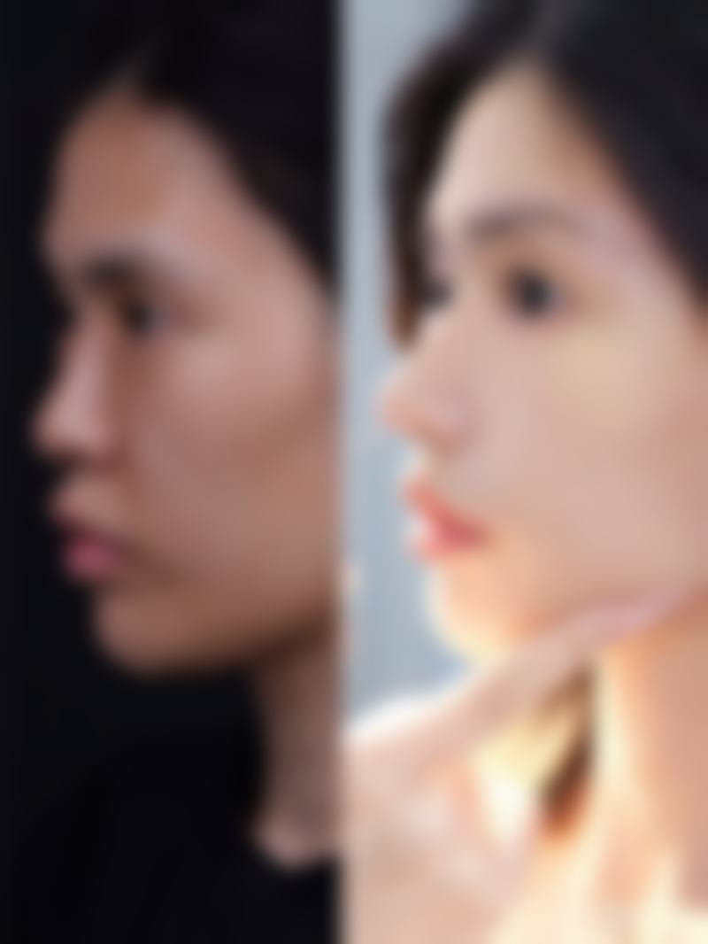 七、昆明五华比尔西希医疗美容诊所真实的顾客评价如下：