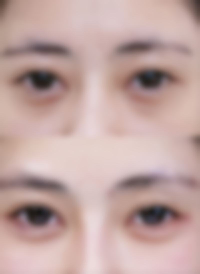 六、长沙叶枝整形医院价格表：（仅供参考）