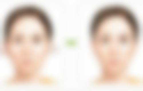 熬夜真会让眼袋变大吗？揭秘熬夜致眼袋成因、分型及有效改善措施 