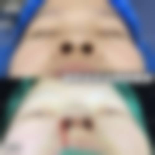 七、温州云谣伊佰丽整形医院价格表：（仅供参考）