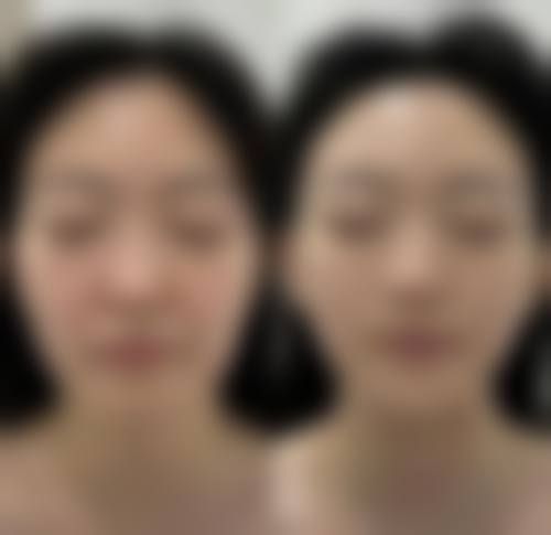庄坤医生在哪家医院怎么预约？