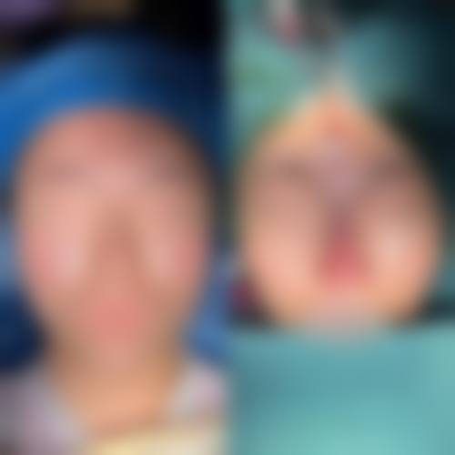 庄坤医生实例
