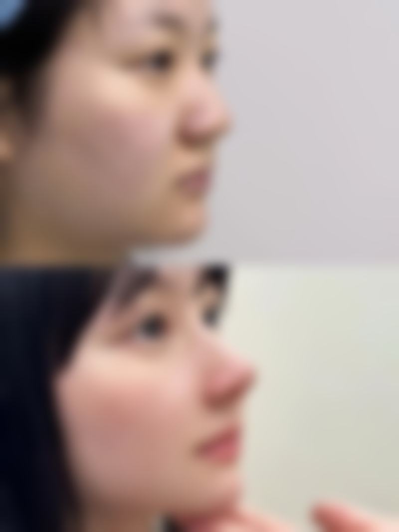 五、浙江杭州市拱墅区星博体医疗美容门诊部实例