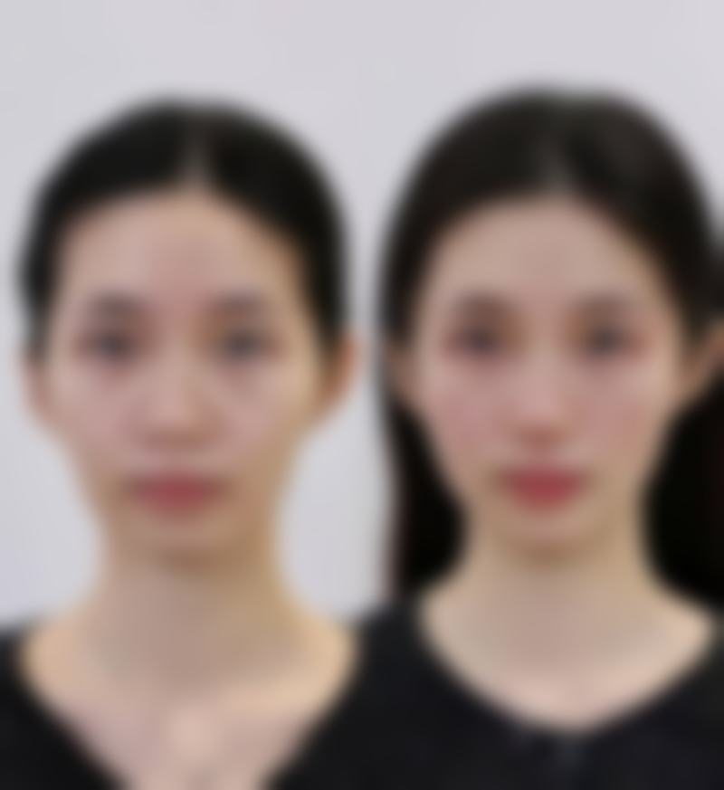 八、郑州禾新颜整形美容医院真实的顾客评价如下：