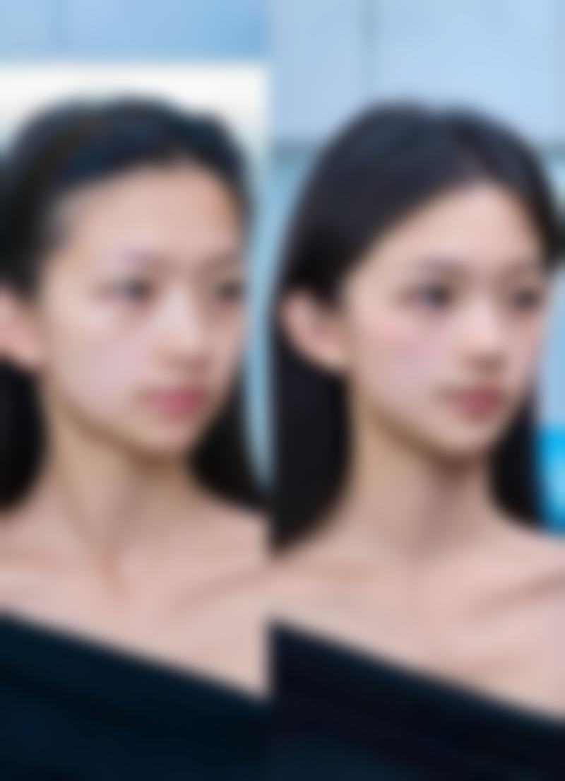 想知道去眼袋后要注意什么吗？做好这些让成效更持久