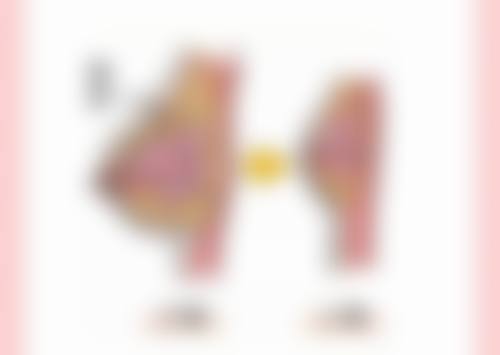 全切双眼皮的显著优势之持久耐用