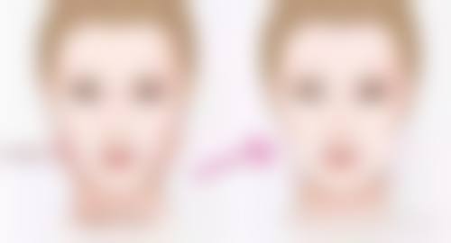 隆胸假体取出后，如何促进身体修复和胸部形态改善？