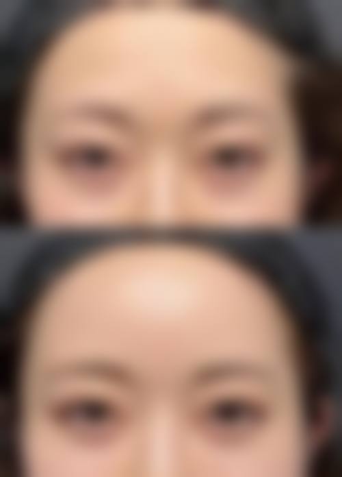 张克医生实例