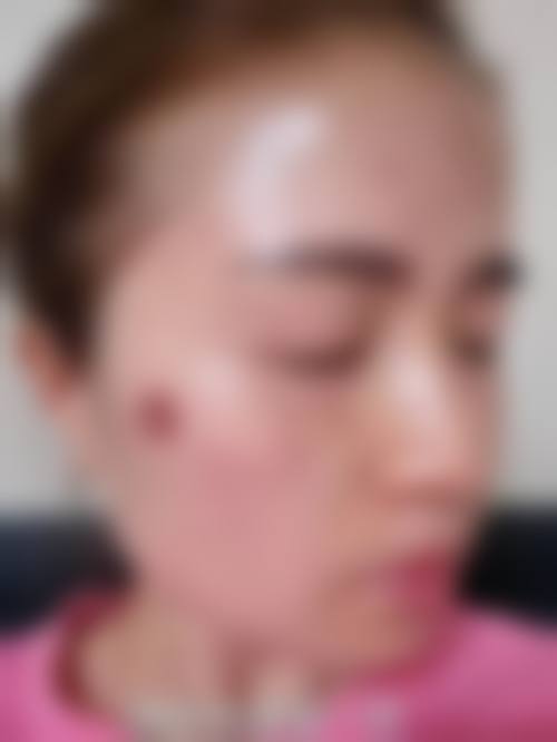 蔡庆水医生实例