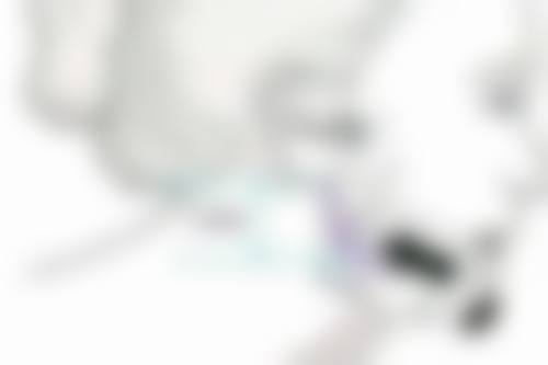 隆胸手术是否需要陪同？陪同助力术前术后，保障安全、护理与心理支持 