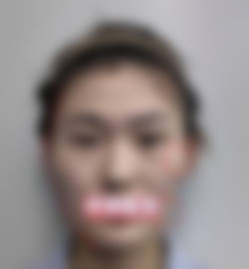 五、韩国Why口腔颌面外科实例