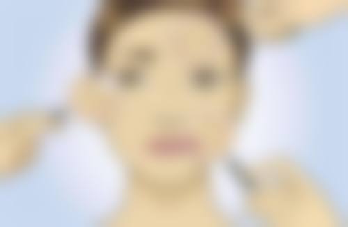 隆鼻的好处知多少?矫正鼻型,修复缺陷