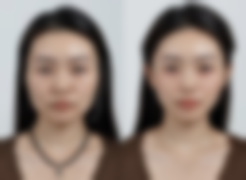 想消除眼袋？掌握这些按摩方法，促进眼周循环、加速代谢，轻松告别熊猫眼！ 
