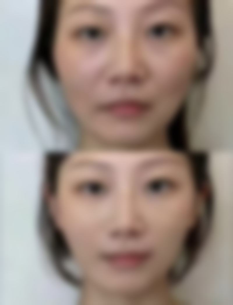 朴贤敬医生在哪家医院怎么预约?