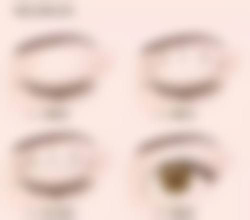 开水烫伤疤痕去除:核心治疗方案之手术治疗