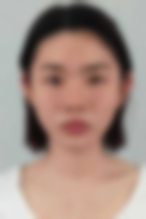 五、广州贝馨医疗美容诊所怎么预约: