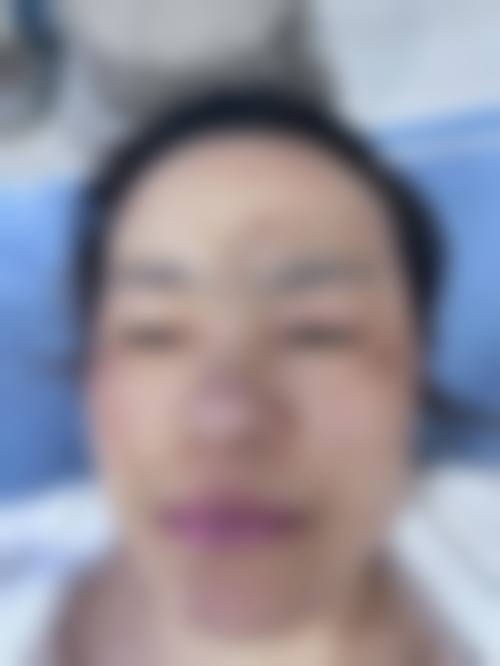 六、广州贝馨医疗美容诊所价格表:(仅供参考)