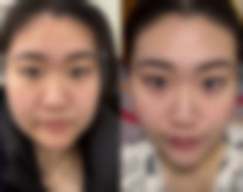 七、广州贝馨医疗美容诊所真实的顾客评价如下: