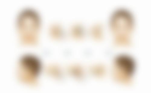 割的双眼皮多久能自然？术后修复阶段大揭秘