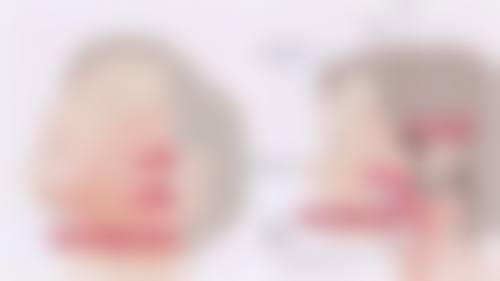 割的双眼皮多久能自然？这些因素影响修复时间