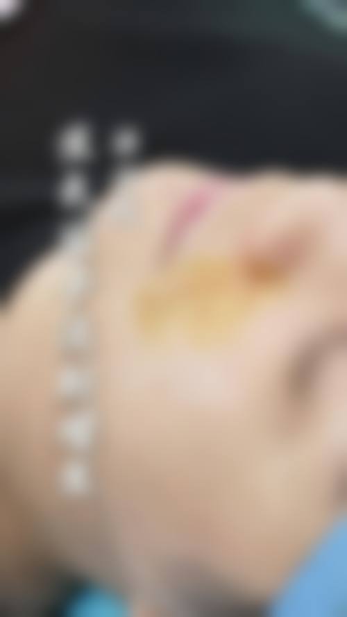 八、宿迁奥黛丽整形美容门诊部真实的顾客评价如下: