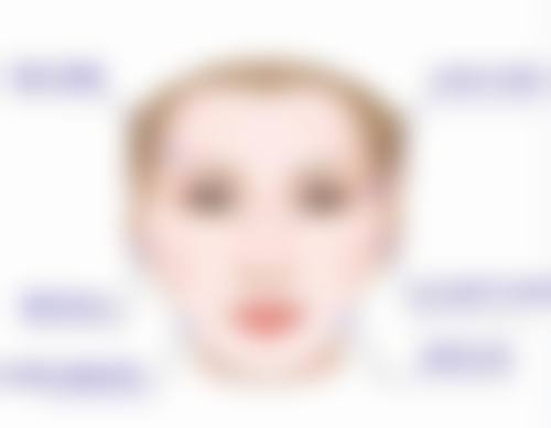 双眼皮拆线后眼角小疙瘩别怕!通用基础处理来帮忙