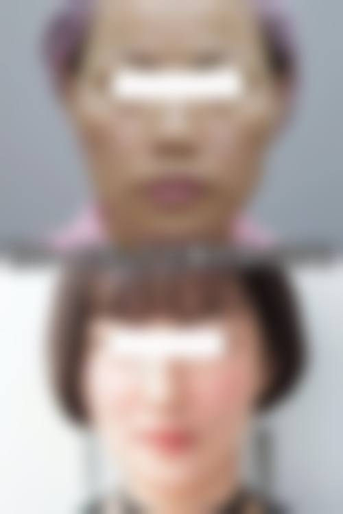 六、运城薛大夫整形美容怎么预约: