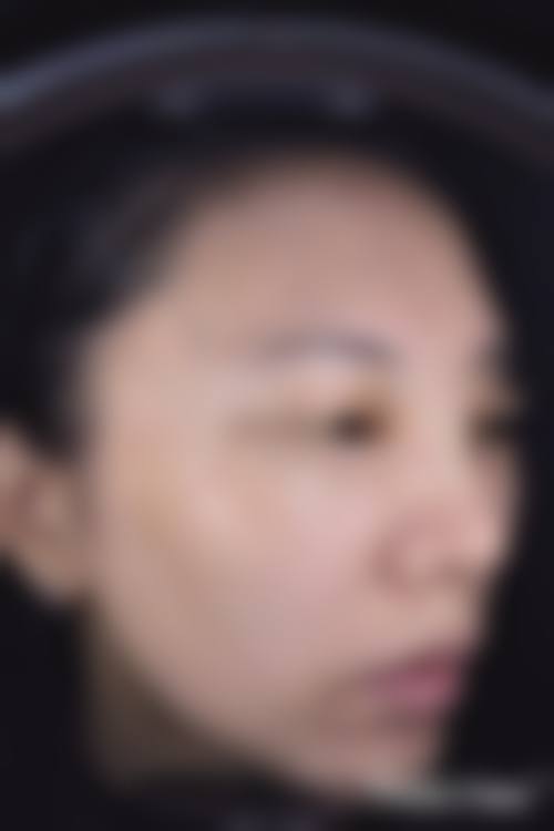 七、秦皇岛医院整形美容科价格表:(仅供参考)