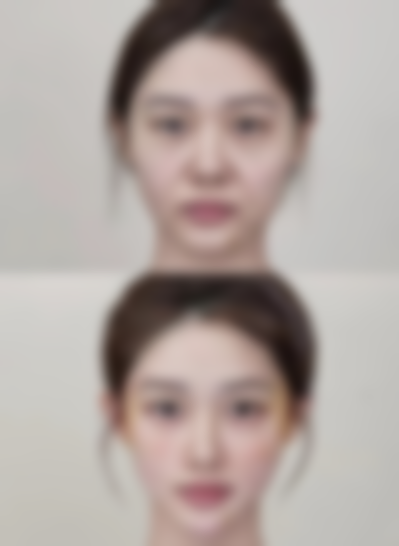 七、运城薛大夫整形美容价格表:(仅供参考)