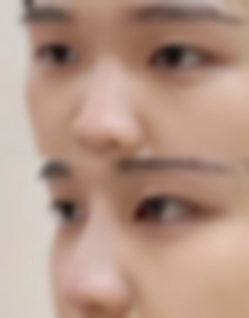 三、运城薛大夫整形美容医生介绍: