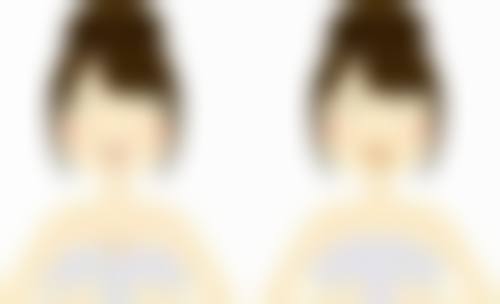全切双眼皮恢复期多久？1 - 6 个月不等，分阶段护理助你快速拥有稳定自然形态