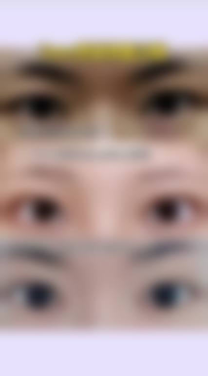 钱鋆医生在哪家医院怎么预约?