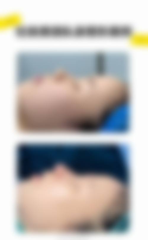 八、郑州亿鑫隆整形医院真实的顾客评价如下: