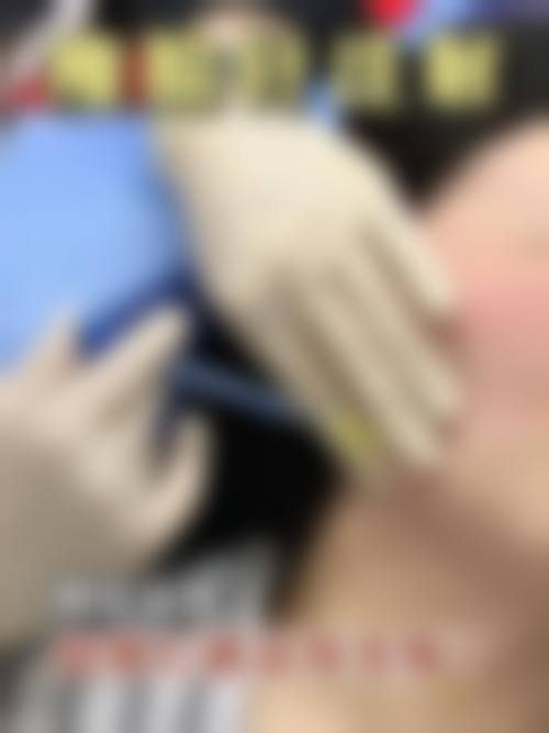 蔡治慧医生怎么样可靠吗?