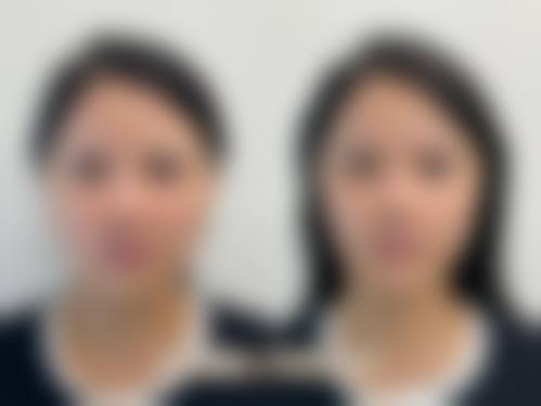 五、景德镇亚菲整形美容医院实例