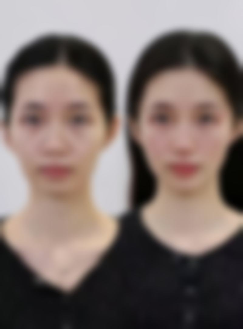 六、郑州亿鑫隆整形医院怎么预约: