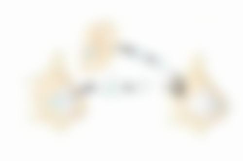 如何轻松拥有大眼睛双眼皮？手术持久变得更美方案