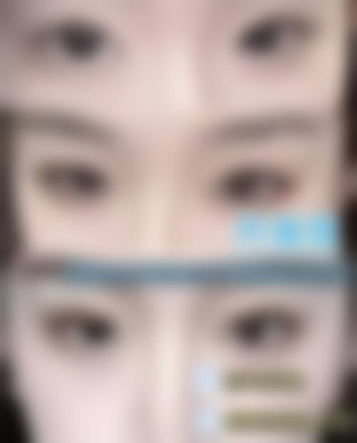 五、张家港康丽整形医院实例