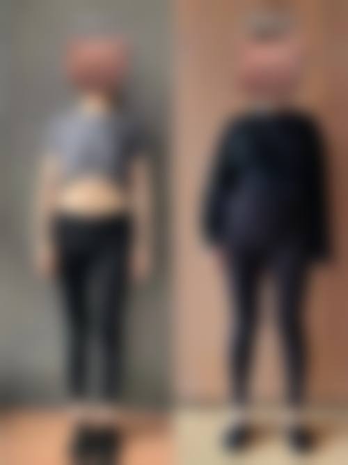 五、驻马店阮夏君医学美容诊所实例