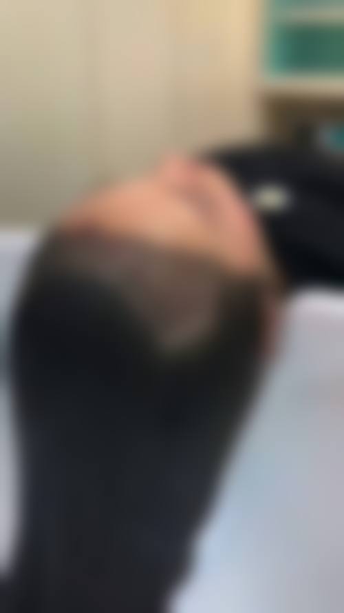 七、玉林贞韩植发医院价格表:(仅供参考)